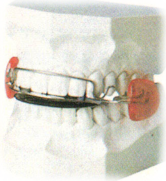 apparecchio mobile