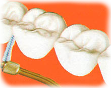 scovolino