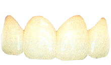 ponti in resina