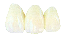 ponti in ceramica