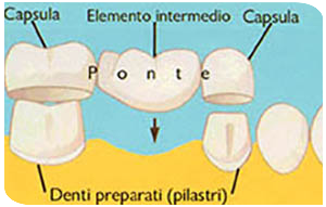 ponte 1