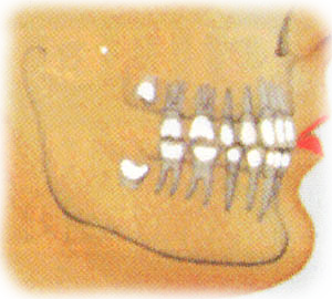 denti del giudizio