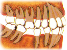 perdita 2