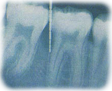 radiografia parodomtologia 2