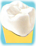 capsula cementata