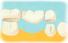 ponte 3a